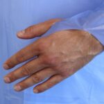 Strong Blue Fluid Resistant Isolation Gowns (Pack 100) - Image 5